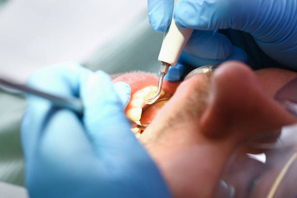 Best Emergency Tooth Extraction  in Glouster, OH