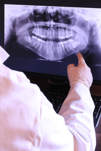 Best Chipped Tooth Repair Near Me  in Glouster, OH
